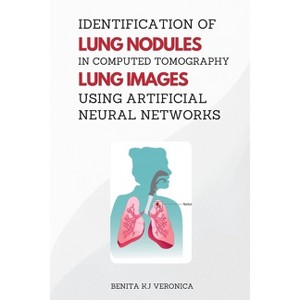 Identification of Lung Nodules in Computed Tomography Lung Images Using Artificial Neural Networks - by  Benita K J Veronica (Paperback) - 1 of 1