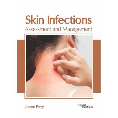 Skin Infections: Assessment and Management - by  Joanne Perry (Hardcover)