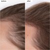 Briogeo Hair Care Destined for Density Mega Strength Peptide Density Serum for Fine Thinning Hair - 1.5 fl oz - Ulta Beauty - 2 of 4
