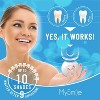 MySmile Teeth Whitening Kit with LED Light, 10 Min Fast Teeth Whitener,18%  CP Teeth Whitening Gel - 2 of 4
