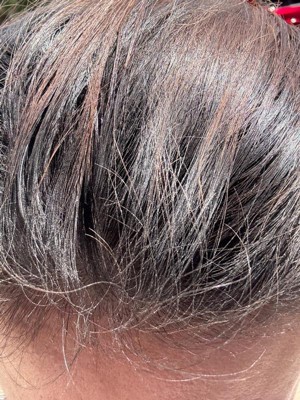 Guest review image 2 of 2, zoom in