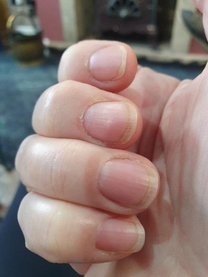 Guest review image 1 of 2, zoom in