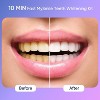 MySmile Premium 10 Min Teeth Whitening Kit with 28 LED Light, 35% CP Teeth Whitening Gel - 2 of 4