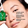 Vichy Normaderm BHA Face Serum - 1.01oz - 3 of 4