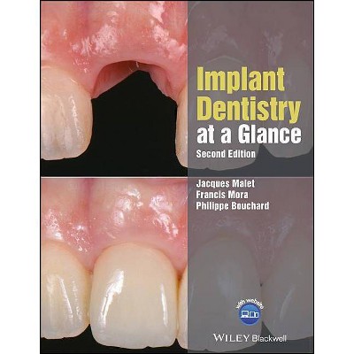 Implant Dentistry at a Glance - (At a Glance (Dentistry)) 2nd Edition by  Jacques Malet & Francis Mora & Philippe Bouchard (Paperback)