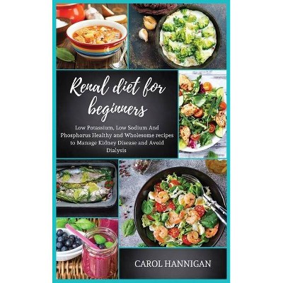 Renal diet for beginners - by  Carol Hannigan (Hardcover)