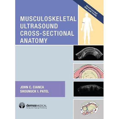 Musculoskeletal Ultrasound Cross-Sectional Anatomy - by  John C Cianca & Shounuck I Patel (Hardcover)