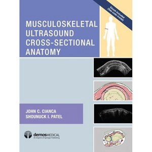 Musculoskeletal Ultrasound Cross-Sectional Anatomy - by  John C Cianca & Shounuck I Patel (Hardcover) - 1 of 1