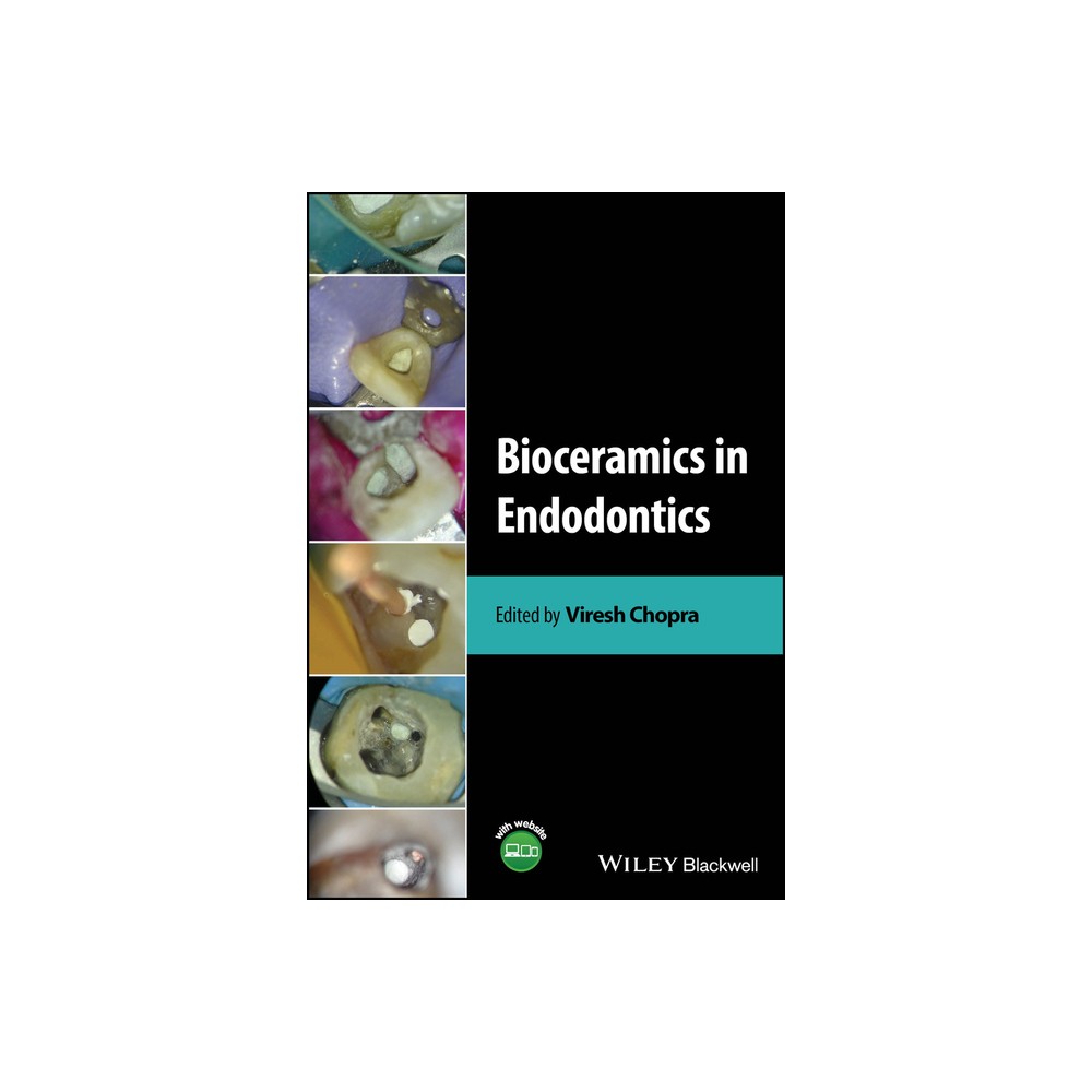 Bioceramics in Endodontics - by Viresh Chopra (Hardcover)