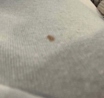 Guest review image 1 of 2, zoom in