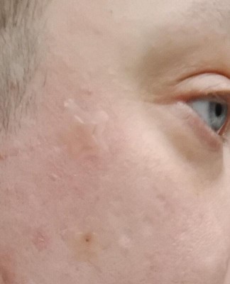 Guest review image 1 of 2, zoom in