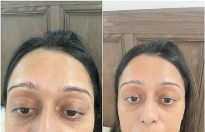 Guest review image 1 of 4, zoom in