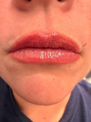 Guest review image 2 of 2, zoom in