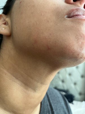 Guest review image 4 of 4, zoom in