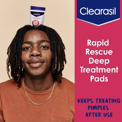 Clearasil Rapid Rescue Oil-Free Acne Treatment Pads, 90 Count