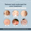 Silicone Scar Sheets Tape, Strips for Scars, C-Section, Tummy Tuck, Keloid Scar Treatment, Silicone Scar Tape for Surgical Scars - 6 Pack - 3 of 4
