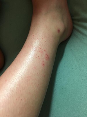 Skintimate Signature Scents Raspberry Rain Women's Shave Gel - Trial ...