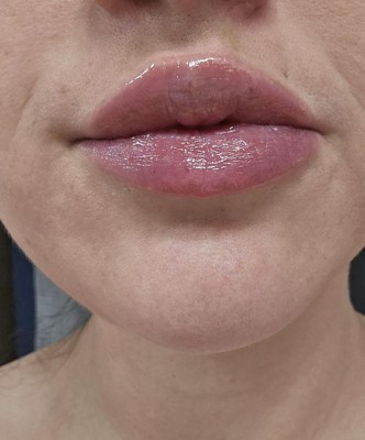 Guest review image 3 of 3, zoom in