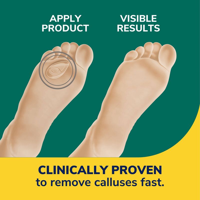 Dr. Scholl&#39;s Callus Removers Seal &#38; Heal Bandage with Hydrogel Technology - 4ct, 5 of 12