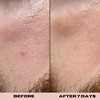 skin magic 10% Glycolic Exfoliating Treatment Tonic for Clear Bright Skin 6 fl. oz. - 3 of 4
