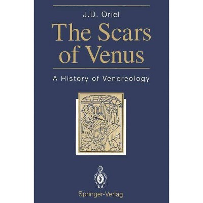 The Scars of Venus - by  J David Oriel (Paperback)