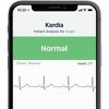 KardiaMobile FDA Cleared Personal EKG Monitor