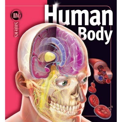 Human Body - (Insiders) by  Linda Calabresi (Hardcover)