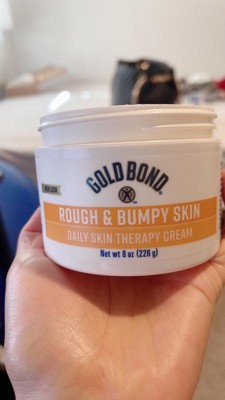 Gold Bond Rough & Bumpy Daily Skin Therapy, 8 Ounce : : Beauty &  Personal Care