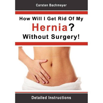 How Will I Get Rid Of My Hernia? Without Surgery! - by  Carsten Bachmeyer (Paperback)