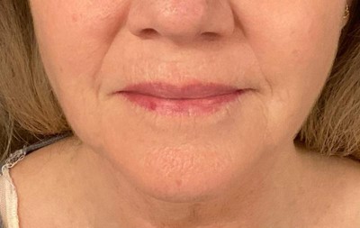 Guest review image 2 of 3, zoom in