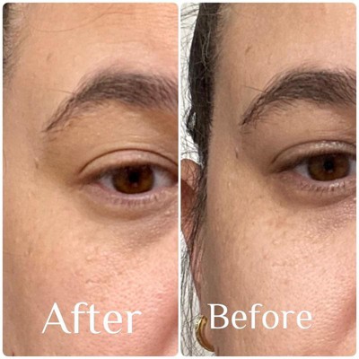 Guest review image 1 of 2, zoom in