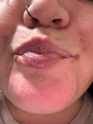 Guest review image 1 of 3, zoom in