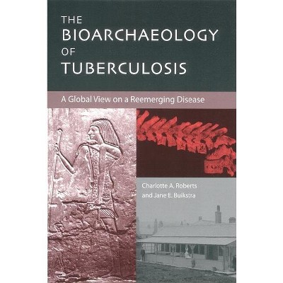 The Bioarchaeology of Tuberculosis - by  Charlotte Roberts & Jane Buikstra (Paperback)
