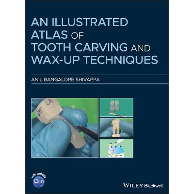 An Illustrated Atlas of Tooth Carving and Wax-Up Techniques - by  Anil Bangalore Shivappa (Hardcover)