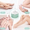 Grocerism 50% Coconut Urea  Cream& 2% Salicylic Acid Cream - Callus & Crack Repair for Feet & Hands - Moisturizing Cream - 3 of 4