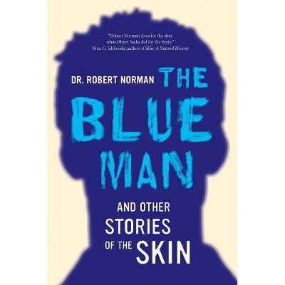 The Blue Man and Other Stories of the Skin - by  Robert A Norman (Hardcover)