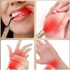 Morfone portable red light therapy device for treating cold sores, rhinitis, oral ulcers and muscle pain - the infrared treatment stick. - 4 of 4