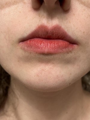 Guest review image 5 of 6, zoom in