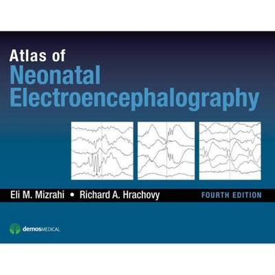 Atlas of Neonatal Electroencephalography - 4th Edition by  Eli M Mizrahi & Richard A Hrachovy (Hardcover)