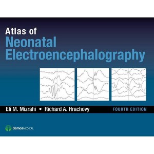 Atlas of Neonatal Electroencephalography - 4th Edition by  Eli M Mizrahi & Richard A Hrachovy (Hardcover) - 1 of 1