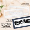 KeaBabies Trio Baby Sonogram Picture Frame, Baby Ultrasound Picture Frames for Baby Nursery, Mom to Be Gifts - 2 of 4
