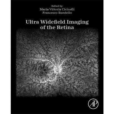 Ultra Widefield Imaging of the Retina - by  Maria Vittoria Cicinelli & Francesco Bandello (Paperback)