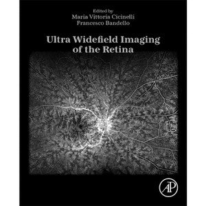 Ultra Widefield Imaging of the Retina - by  Maria Vittoria Cicinelli & Francesco Bandello (Paperback) - 1 of 1