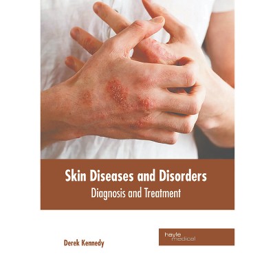 Skin Diseases and Disorders: Diagnosis and Treatment - by  Derek Kennedy (Hardcover)