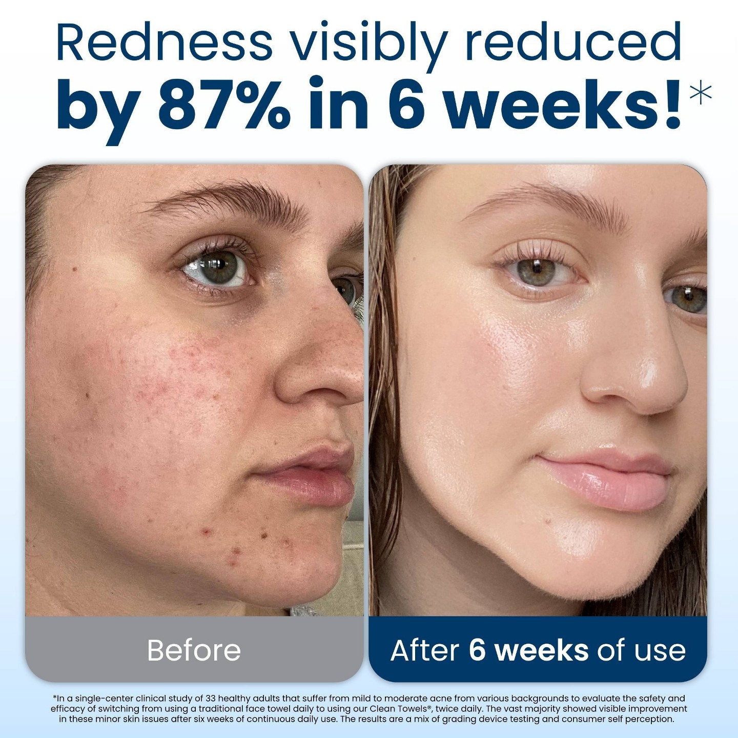 Полотенца Clean Skin Club Disposable Face for Improved Skin - XL - 50ct — фото 3