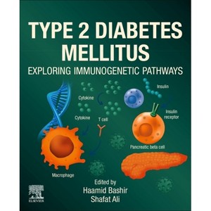 Type 2 Diabetes Mellitus - by  Haamid Bashir & Shafat Ali (Paperback) - 1 of 1