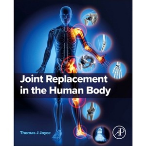 Joint Replacement in the Human Body - by  Thomas J Joyce (Paperback) - 1 of 1