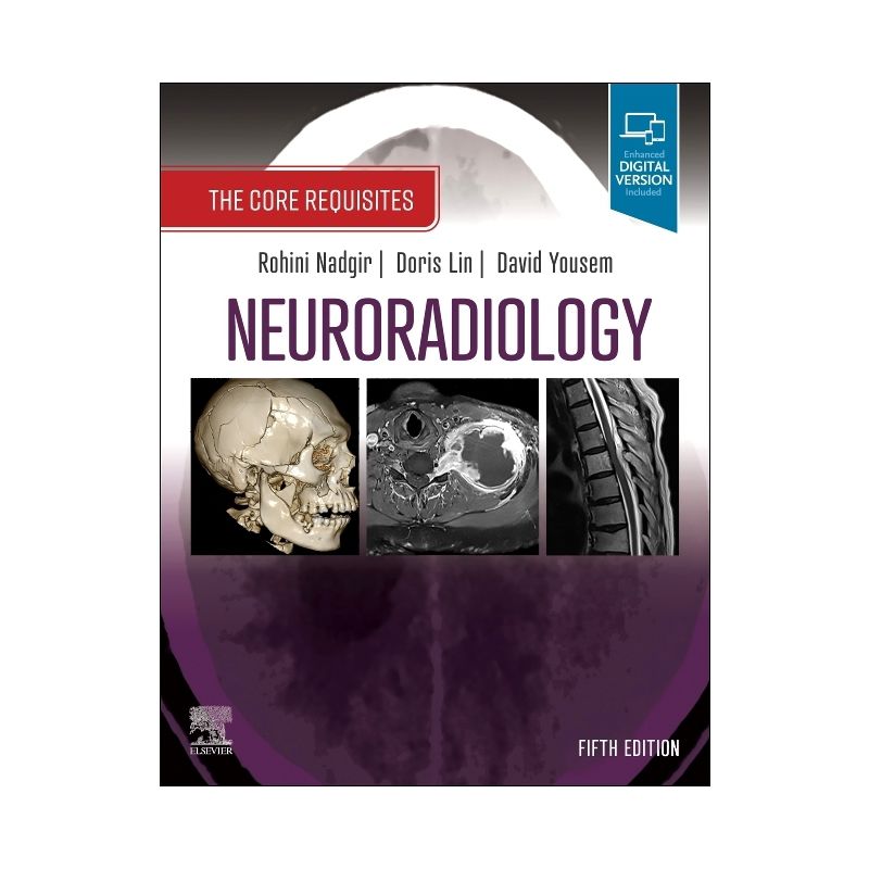 Neuroradiology - (The Core Requisites) 5th Edition by  Rohini Nadgir & Doris Lin & David M Yousem (Paperback), 1 of 2