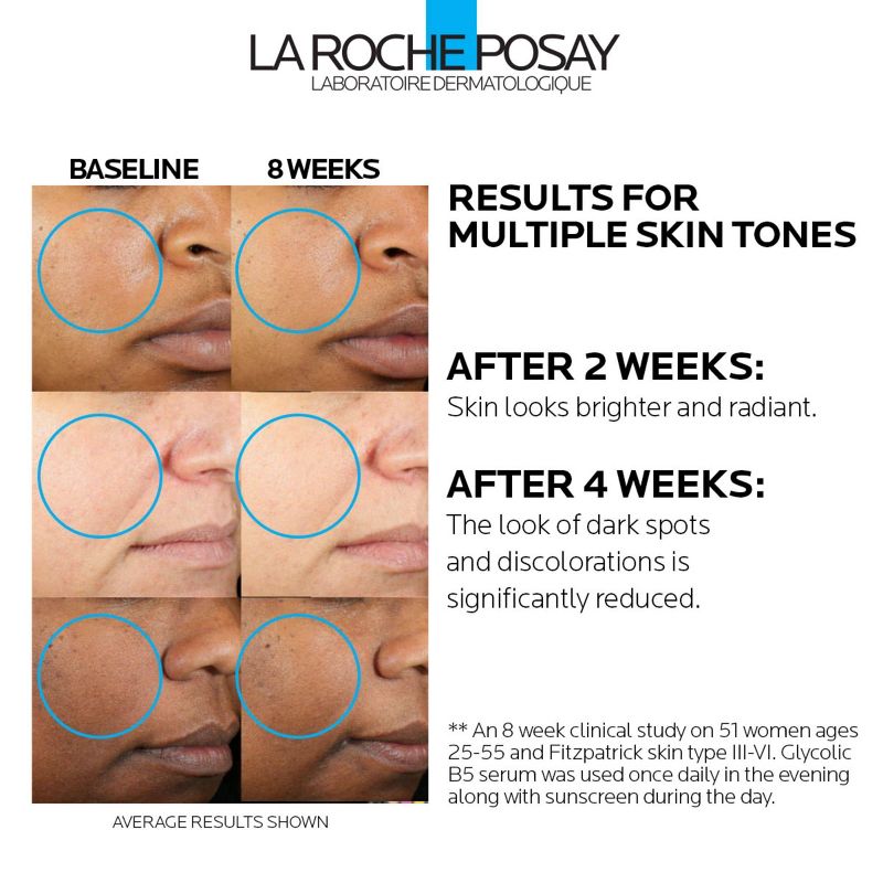 La Roche Posay Dark Spot Corrector, Glycolic B5 Face Serum &#38; Anti Aging Serum for Sensitive Skin - 1oz, 6 of 13