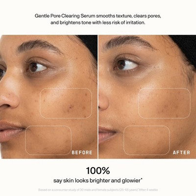 Versed Skin Refine Gentle Pore Clearing Serum - 1 fl oz: Vegan, Salicylic Acid, Paraben-Free, For Normal & Oily Skin